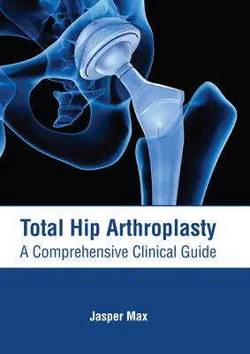 Arthroplastie totale de la hanche : Un guide clinique complet - Total Hip Arthroplasty: A Comprehensive Clinical Guide