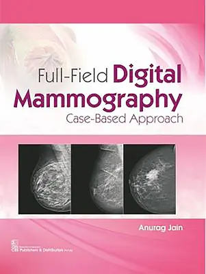 Mammographie numérique plein champ : Approche par cas - Full-Field Digital Mammography: Case-Based Approach