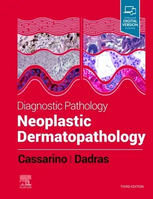 Pathologie diagnostique : Dermatopathologie néoplasique - Diagnostic Pathology: Neoplastic Dermatopathology