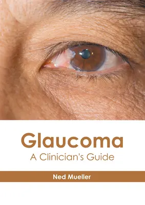 Glaucome : Guide du clinicien - Glaucoma: A Clinician's Guide