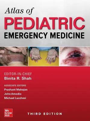 Atlas de la médecine d'urgence pédiatrique, troisième édition - Atlas of Pediatric Emergency Medicine, Third Edition