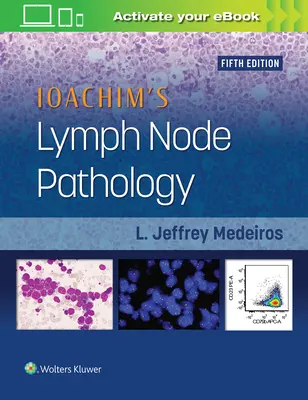 Pathologie du ganglion lymphatique de Ioachim - Ioachim's Lymph Node Pathology