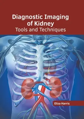 Imagerie diagnostique du rein : Outils et techniques - Diagnostic Imaging of Kidney: Tools and Techniques