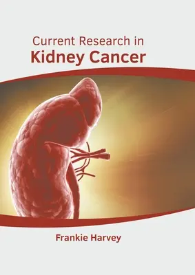 Recherche actuelle sur le cancer du rein - Current Research in Kidney Cancer