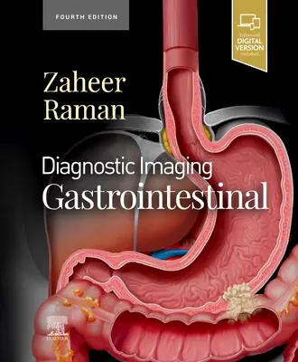 Imagerie diagnostique : Gastro-intestinal - Diagnostic Imaging: Gastrointestinal