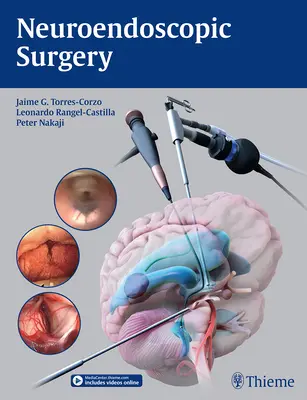 Chirurgie neuroendoscopique - Neuroendoscopic Surgery