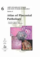 Atlas de la pathologie placentaire - Atlas of Placental Pathology