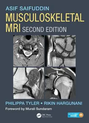 IRM musculo-squelettique - Musculoskeletal MRI