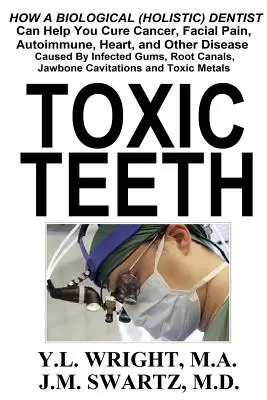 Toxic Teeth : Comment un dentiste biologique (holistique) peut vous aider à guérir le cancer, les douleurs faciales, les maladies auto-immunes, cardiaques et autres maladies. - Toxic Teeth: How a Biological (Holistic) Dentist Can Help You Cure Cancer, Facial Pain, Autoimmune, Heart, and Other Disease Caused