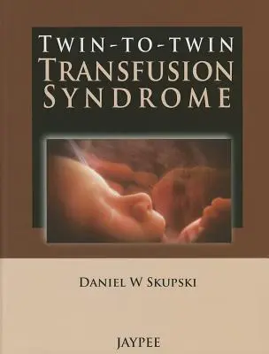 Syndrome de transfusion de jumeaux à jumeaux - Twin-To-Twin Transfusion Syndrome