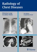 Radiologie des maladies thoraciques - Radiology of Chest Diseases