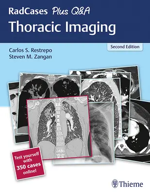 Radcases Plus Q&A Imagerie thoracique - Radcases Plus Q&A Thoracic Imaging