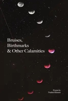 Ecchymoses, taches de naissance et autres calamités - Bruises, Birthmarks & Other Calamities