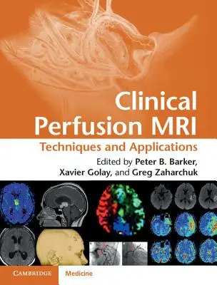 IRM de perfusion clinique : Techniques et applications - Clinical Perfusion MRI: Techniques and Applications