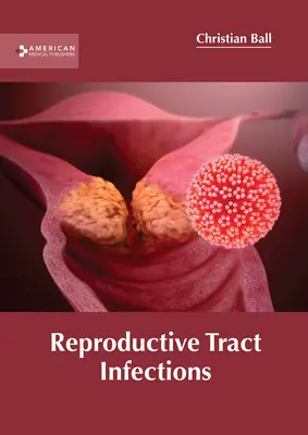 Infections de l'appareil reproducteur - Reproductive Tract Infections