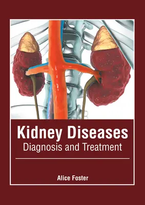 Maladies rénales : Diagnostic et traitement - Kidney Diseases: Diagnosis and Treatment