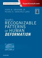 Smith's Recognizable Patterns of Human Deformation (en anglais) - Smith's Recognizable Patterns of Human Deformation