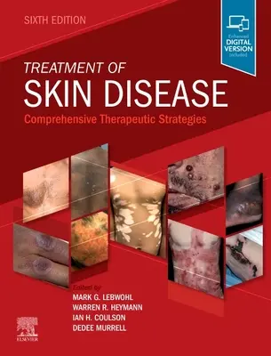 Traitement des maladies de la peau : Stratégies thérapeutiques globales - Treatment of Skin Disease: Comprehensive Therapeutic Strategies