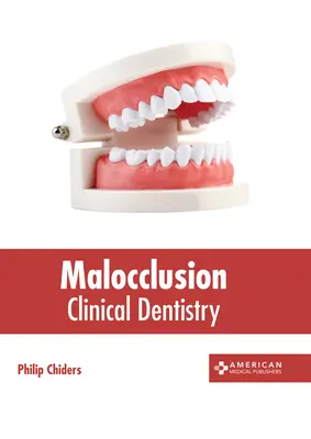 Malocclusion : Dentisterie clinique - Malocclusion: Clinical Dentistry