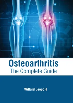 L'arthrose : Le guide complet - Osteoarthritis: The Complete Guide