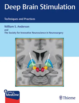 Stimulation cérébrale profonde : Techniques et pratiques - Deep Brain Stimulation: Techniques and Practices