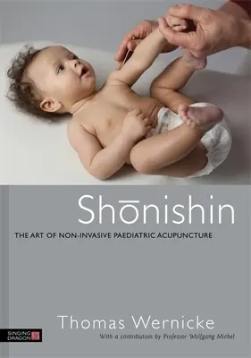 Shonishin : l'art de l'acupuncture pédiatrique non invasive - Shonishin: The Art of Non-Invasive Paediatric Acupuncture