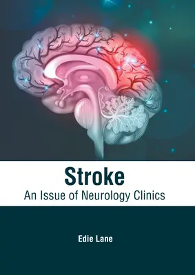 Stroke : Un numéro de Neurology Clinics - Stroke: An Issue of Neurology Clinics