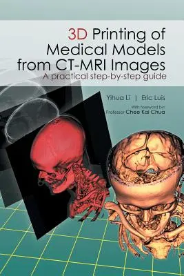 Impression 3D de modèles médicaux à partir d'images de CT-MRI : Un guide pratique étape par étape - 3D Printing of Medical Models from CT-MRI Images: A Practical step-by-step guide