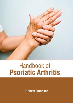 Manuel de l'arthrite psoriasique - Handbook of Psoriatic Arthritis