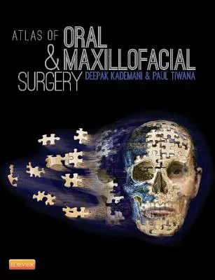 Atlas de la chirurgie orale et maxillo-faciale - Atlas of Oral and Maxillofacial Surgery
