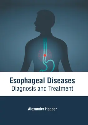 Maladies de l'oesophage : Diagnostic et traitement - Esophageal Diseases: Diagnosis and Treatment