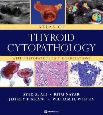 Atlas de la cytopathologie thyroïdienne : Avec corrélations histopathologiques - Atlas of Thyroid Cytopathology: With Histopathologic Correlations