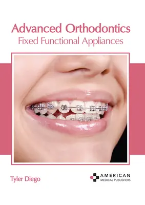 Orthodontie avancée : Appareils fonctionnels fixes - Advanced Orthodontics: Fixed Functional Appliances