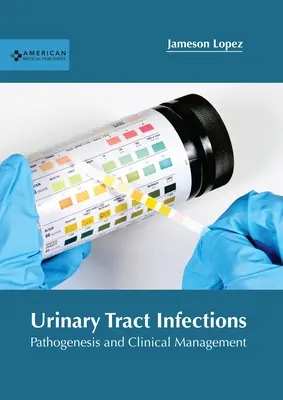 Infections urinaires : Pathogenèse et gestion clinique - Urinary Tract Infections: Pathogenesis and Clinical Management