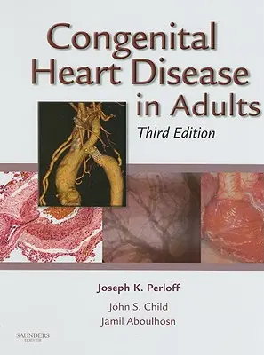 La cardiopathie congénitale chez l'adulte - Congenital Heart Disease in Adults