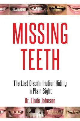 Les dents manquantes : La dernière discrimination cachée à la vue de tous - Missing Teeth: The Last Discrimination Hiding in Plain Sight