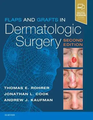 Les lambeaux et les greffes en chirurgie dermatologique - Flaps and Grafts in Dermatologic Surgery
