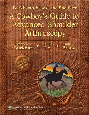 Le point de vue de Burkhart sur l'épaule - Le guide du cow-boy sur l'arthroscopie avancée de l'épaule - Burkhart's View of the Shoulder - A Cowboy's Guide to Advanced Shoulder Arthroscopy