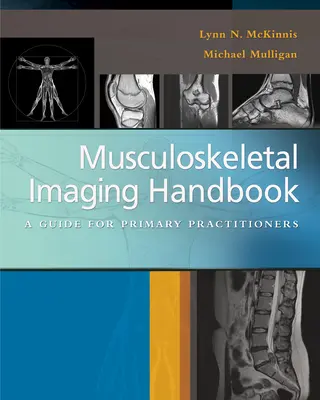 Manuel d'imagerie musculo-squelettique : Un guide pour les praticiens de premier recours - Musculoskeletal Imaging Handbook: A Guide for Primary Practitioners