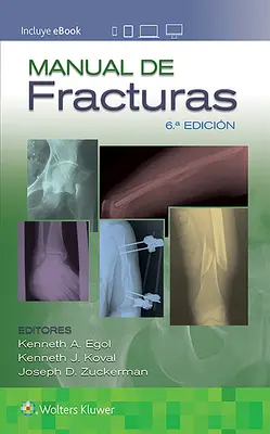 Manuel de Fractures - Manual de Fracturas