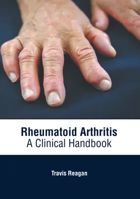 La polyarthrite rhumatoïde : Un manuel clinique - Rheumatoid Arthritis: A Clinical Handbook