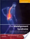 Le syndrome du désalignement : Diagnostic et traitement des douleurs pelviennes et dorsales courantes - The Malalignment Syndrome: Diagnosis and Treatment of Common Pelvic and Back Pain