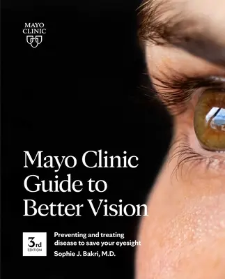 Guide de la clinique Mayo pour une meilleure vision (3e édition) : Prévenir et traiter les maladies pour préserver votre vue - Mayo Clinic Guide to Better Vision (3rd Edition): Preventing and Treating Disease to Save Your Eyesight