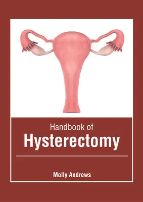 Manuel d'hystérectomie - Handbook of Hysterectomy
