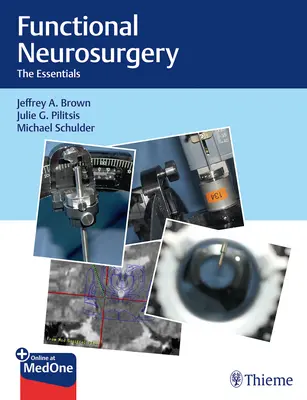 Neurochirurgie fonctionnelle : L'essentiel - Functional Neurosurgery: The Essentials