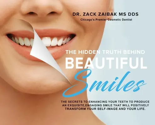 La vérité cachée derrière les beaux sourires : Les secrets de l'amélioration de votre dentition pour obtenir un sourire exquis et engageant qui transformera positivement votre vie. - The Hidden Truth Behind Beautiful Smiles: The secrets to enhancing your teeth to produce an exquisite, engaging smile that will positively transform y