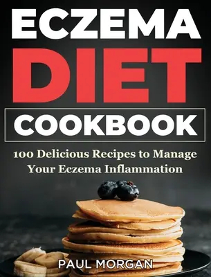 Eczema DIet Cookbook : 100 recettes délicieuses pour gérer l'inflammation de l'eczéma - Eczema DIet Cookbook: 100 Delicious Recipes to Manage your Eczema Inflammation