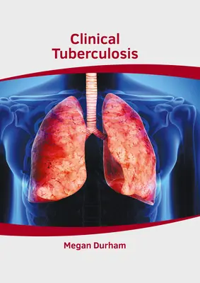 Tuberculose clinique - Clinical Tuberculosis