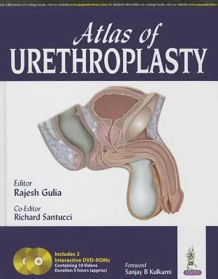 Atlas de l'urétroplastie - Atlas of Urethroplasty