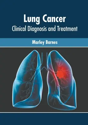 Cancer du poumon : Diagnostic clinique et traitement - Lung Cancer: Clinical Diagnosis and Treatment